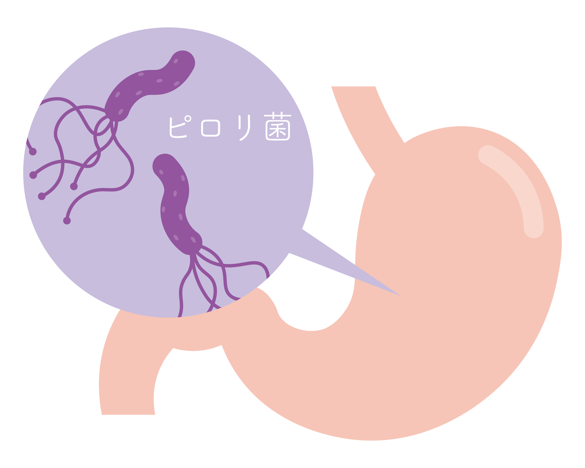 若い世代でも増加中の胃がんリスク、その予防法とは？